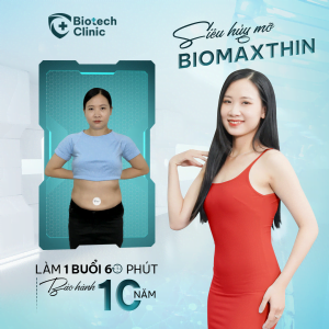Cân nặng và số đo giảm xuống rõ rệt sau khi làm Giảm béo BioMaxthin 