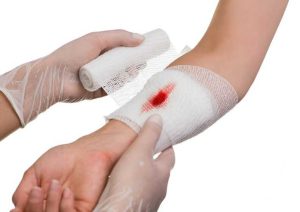 Lá cây dong giúp điều trị vết thương chảy máu 