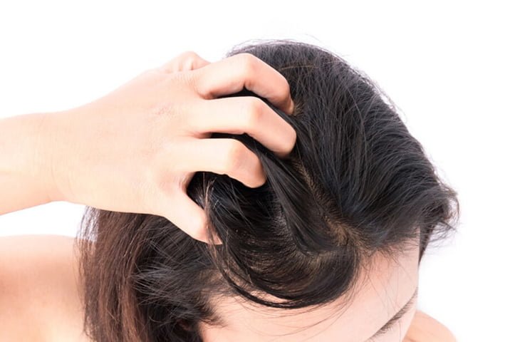 Không làm sạch da đầu sẽ rất dễ khiến tóc bạn có mùi khó chịu
