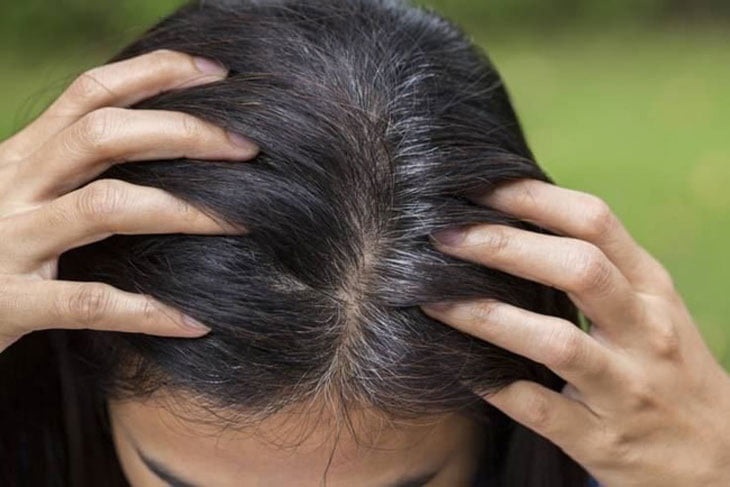 Hà thủ ô có tác dụng trong việc chữa một số vấn đề tóc